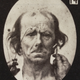 Image for article titled Terrifying, Century-Old Photographs from Neuroscience Experiments